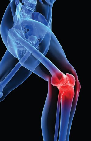 Medial Collateral Ligament Knee Injury, Joondalup, Perth Chiropractor